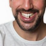 man with missing tooth